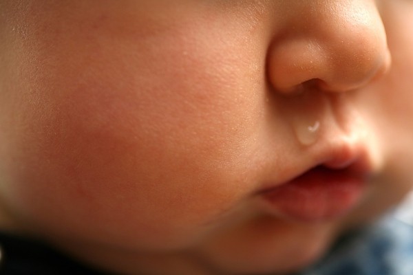 Mẹo trị sổ mũi cho bé bằng các phương pháp thiên nhiên