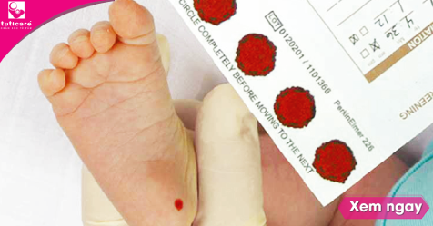 Lấy máu gót chân cho trẻ sau sinh và những điều mẹ cần biết