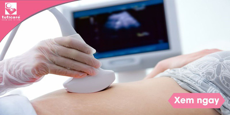 3 mốc siêu âm dị tật thai nhi mẹ bầu cần nằm lòng