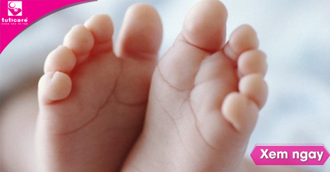 Hội chứng bàn chân bẹt ở trẻ: Nguyên nhân và dấu hiệu nhận biết