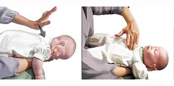 4 phút vàng xử lý hóc dị vật cho trẻ với nghiệm pháp Heimlich( có clip)