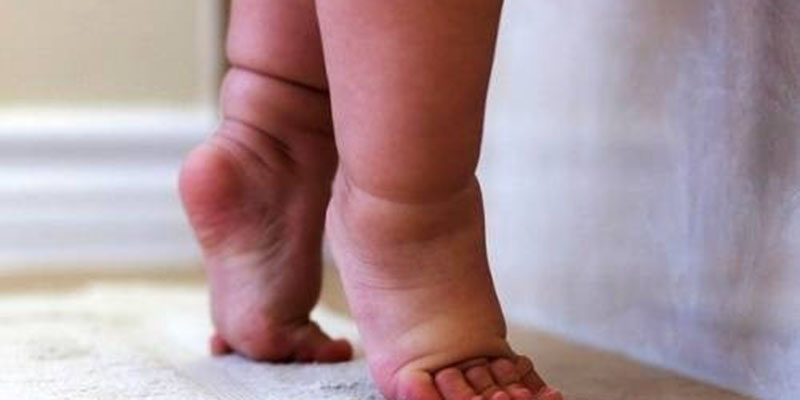 Sau 2 tuổi bé vẫn đi kiễng chân, nhón chân mẹ cần đưa con tới gặp bác sĩ