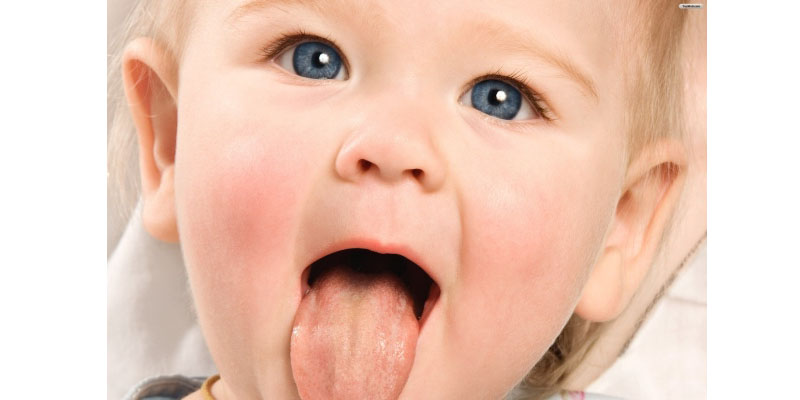 Những dấu hiệu của lưỡi bé mẹ nên lưu ý