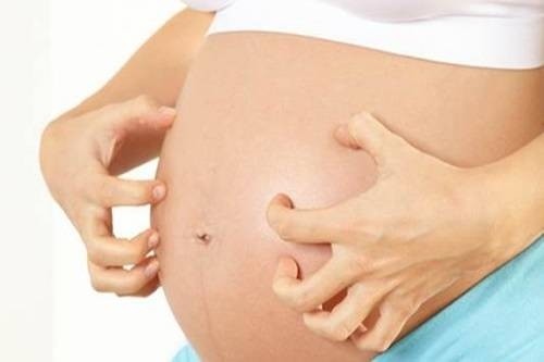 Nguy hiểm hiện tượng ứ mật thai kỳ